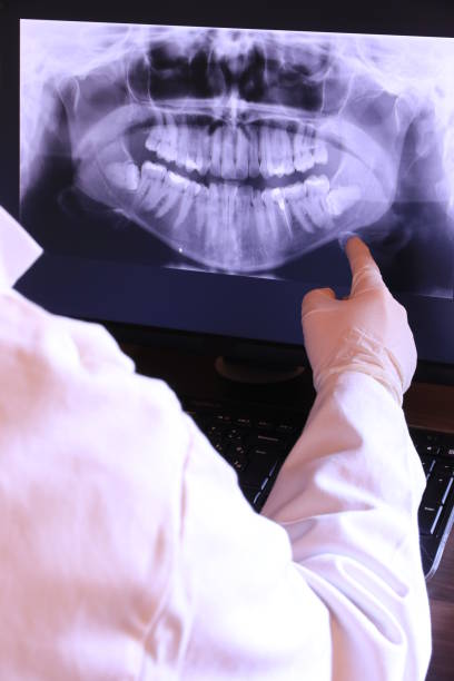 Best Emergency Treatment for Toothache in Shasta Lake, CA
