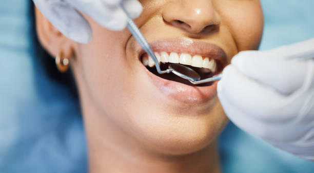 Best Same-Day Emergency Dentist in Shasta Lake, CA
