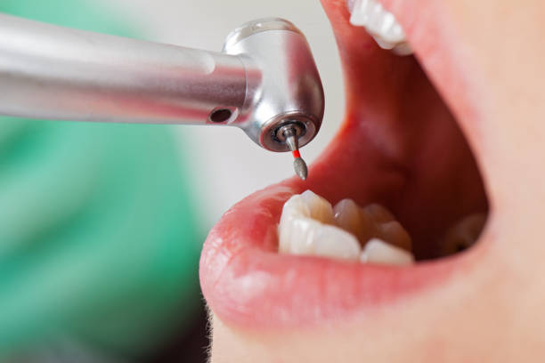 Best Pediatric Emergency Dentist in Shasta Lake, CA